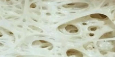 La maglia glutinica La maglia glutinica